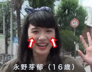 永野芽郁のえくぼはなぜ目立つ？