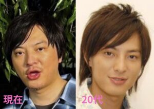 顔が変わったと話題！昔と現在を画像で比較